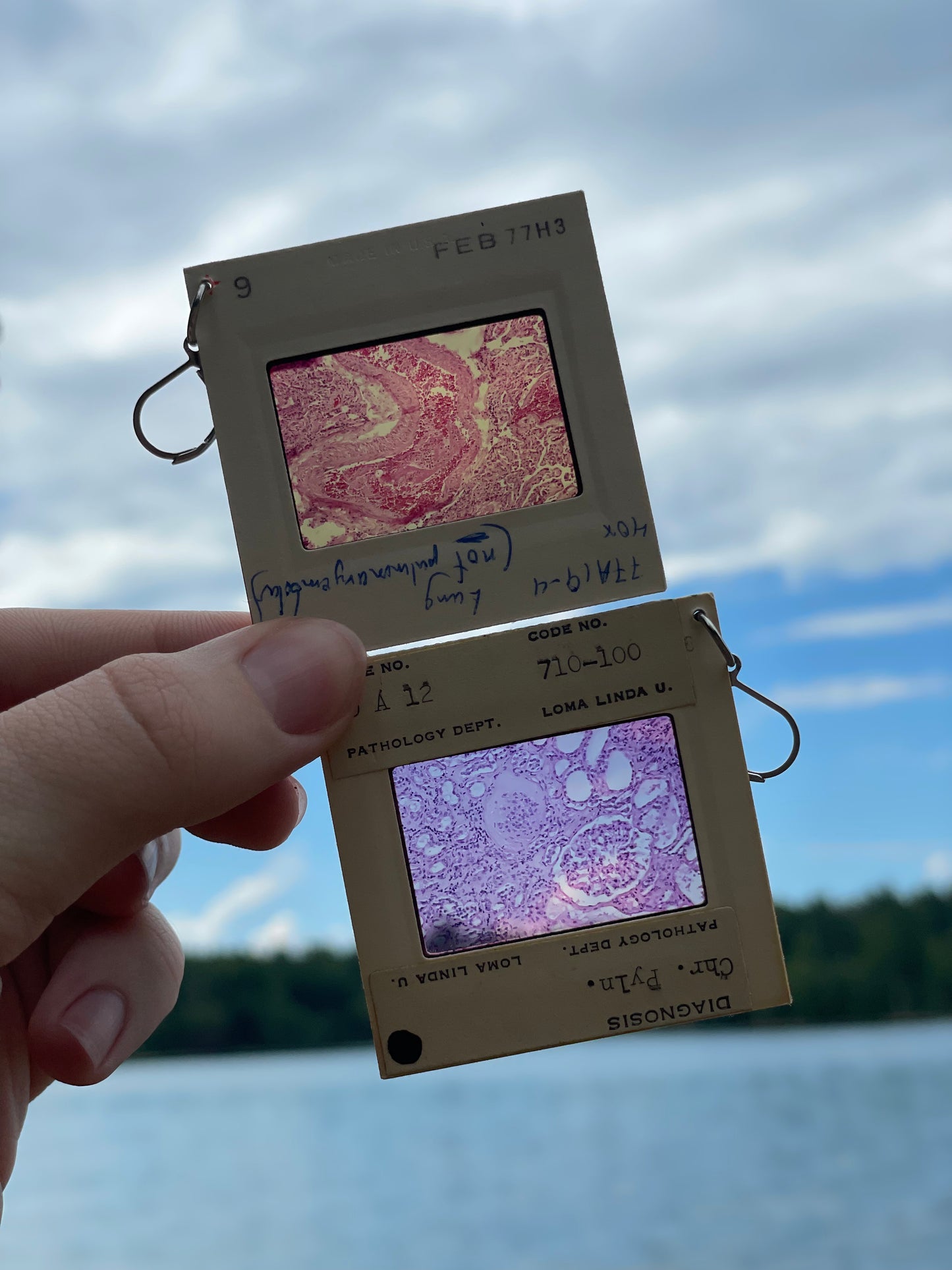 1980's Medical Images Earrings