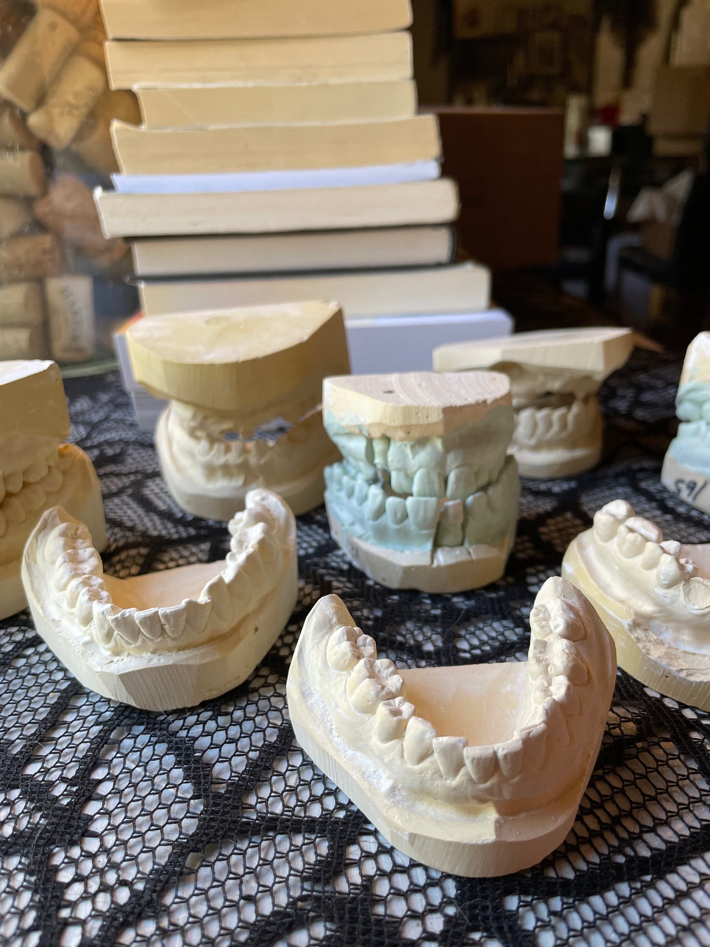 Random Dental Plaster Molds