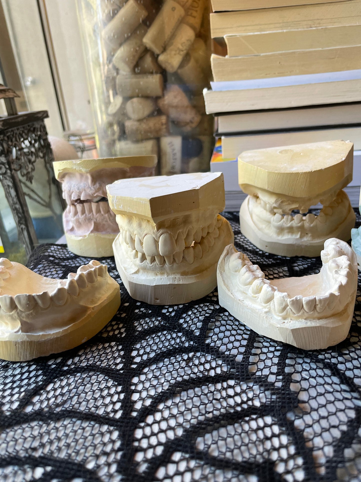 Random Dental Plaster Molds